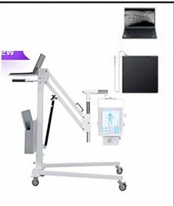 RX portátil, electrónica, tecnología, sistemas
